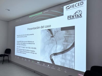 Edición anterior del curso, momento 25 de 35